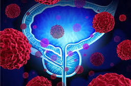 Artificial intelligence analyses corroborates the GUCA2A gene as a promising biomarker for the diagnosis of colon cancer