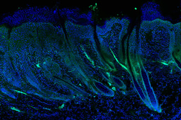 From discovery to real-world applications — a Q&A with Dr Florence Bietrix