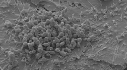 After the Paper: Pneumococcal-Epithelial Interactions