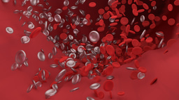 Thrombosis Journal - Q&A with Prof. Rob Medcalf, PhD