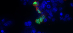 What Guided Us to DNA-Guided CRISPR