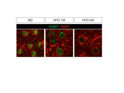 Polyglutamine binding protein 1(PQBP1) mediates high calorie-induced cognitive impairment