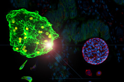 Blocking cancer stem cell functions in colon tumors using a drug initially developed to treat cocaine addiction