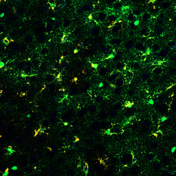 A metabolic switch in astrocytes converts nociceptive injury into persistent pain