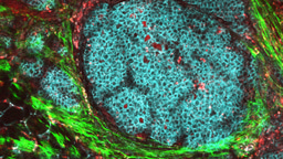 Call for papers: Tumor Microenvironment Crosstalk and Therapeutic Implications