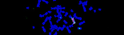 AmpliconReconstructor – revealing focally amplified rearrangements in cancer