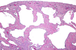 Call for papers: Mechanisms of Tissue Fibrosis