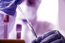 The COVID-19 XPRIZE and the need for scalable, fast, and widespread testing
