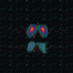 Relative sparing of dopaminergic terminals in the caudate nucleus is a feature of rest tremor in Parkinson’s disease
