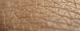 #InMice - but on human skin: colonisation and clearance of S. aureus