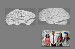 Glutathione and Iron Interplay in Alzheimer's: A Clue for Intervention?