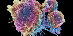 Top 100 in Cancer 2023 | Scientific Reports