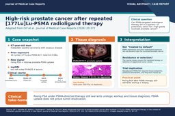 When PSMA-targeted therapy is not enough: high-risk localized prostate cancer after repeated [177Lu]Lu-PSMA radioligand therapy