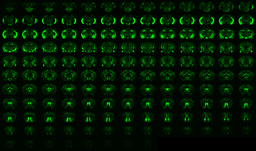 Discovery of a Unified Autism Circuit Signature via AI-Powered Whole-Brain Analysis
