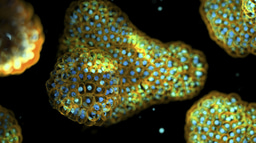 Call for papers: Patient-derived organoids and xenografts Collection