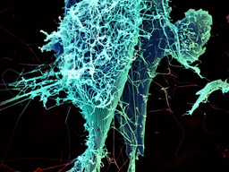 The Ebola Bundibugyo virus outbreak: clinical studies in progress