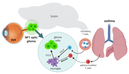 Determining why children with asthma have a lower incidence of brain tumors