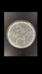 When is it better to be a jack of all trades than a master of one? Why phage evolve into multi-host generalists in diverse microbial communities. 