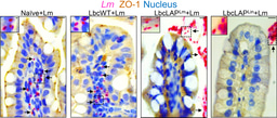 Epithelial Cell Contact is Critical for Probiotic Action 