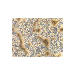 A handbook for making insulin-secreting β cells