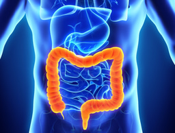 Data-driven identification of modifiable risk factors for colorectal cancer in Palestine using machine learning methods
