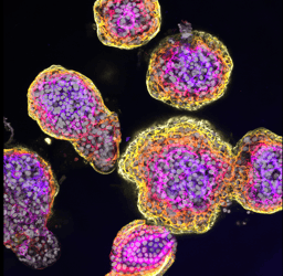 Linking mutations to cancer development