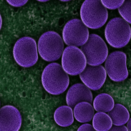 Probiotic Bacillus decolonizes pathogenic Staphylococcus aureus