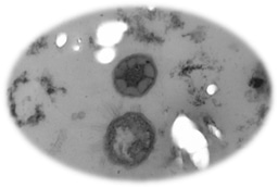 Dominant green sulfur bacteria inside coral skeleton