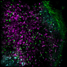 The lymph node is not just a waystation for metastasis