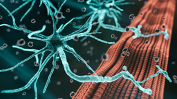 Call for papers: Post-translational modification-derived mechanisms in neurodegeneration Collection