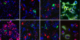 Our built-in protection from coronavirus infection