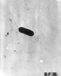 Same but Different: Why Are All Listeria monocytogenes Not Created Equal?