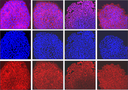 Targeting CREB-binding protein (CBP) abrogates colorectal cancer stemness through epigenetic regulation of C-MYC