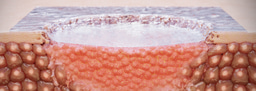 Strain-Programmed Patch for Diabetic Wound Healing