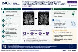 When SIADH Meets PRES: A Rare Neuroendocrine Link Uncovered