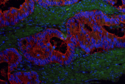 Establishing a link between G9a activity and pluripotency in colorectal cancer stem cells