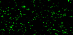 Cracking the Archaeal Cell Wall: How a hydrolase overturned a 50-year-old paradigm
