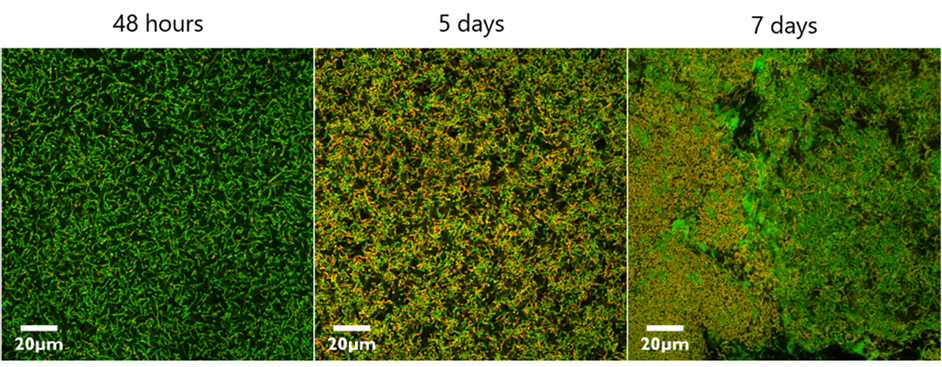 Biofilm Viability Checker: Creating a tool to calculate biofilm ...