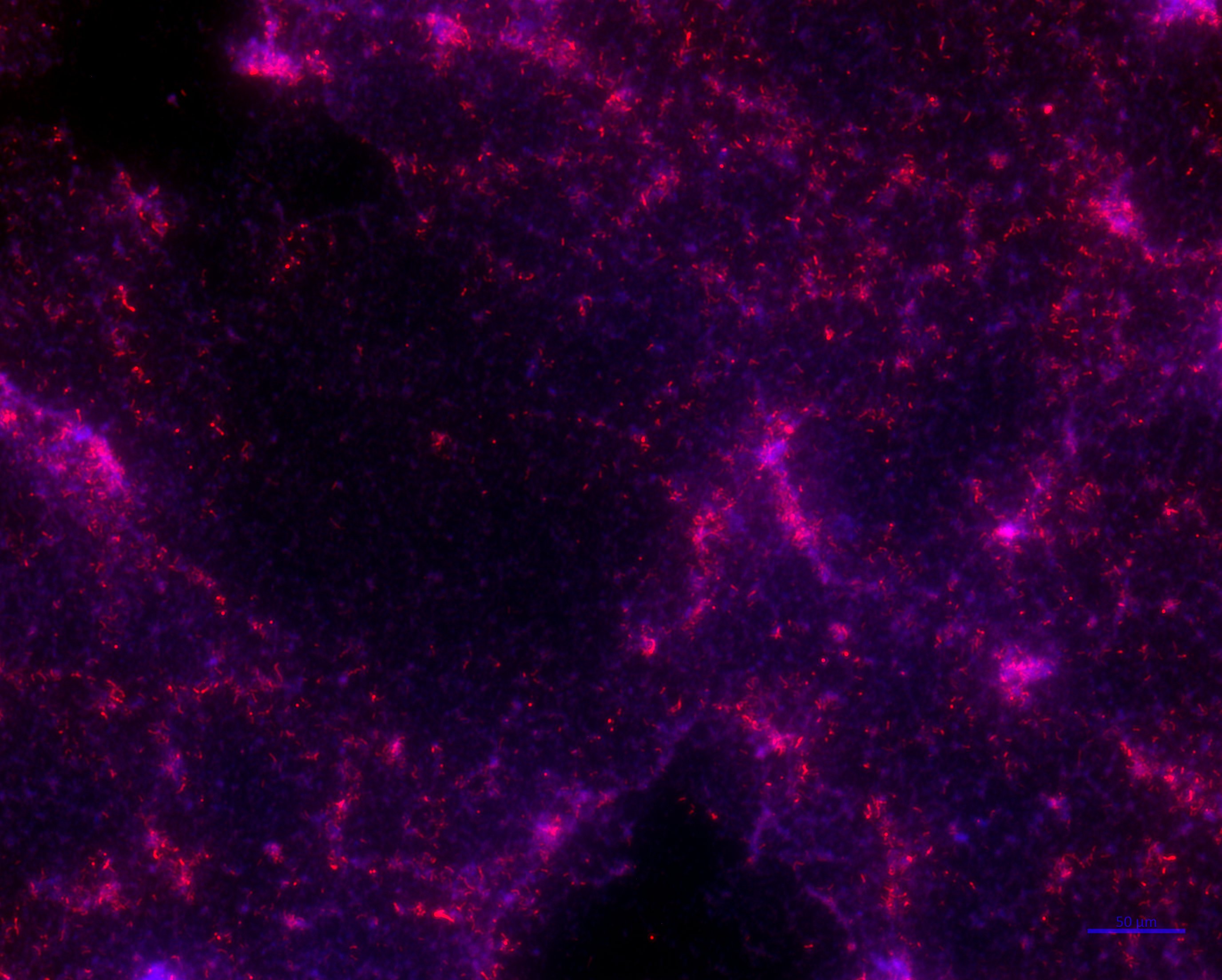 Bottom-up engineering a pathological cell signaling pathway on an organ-on-a-chip instrument