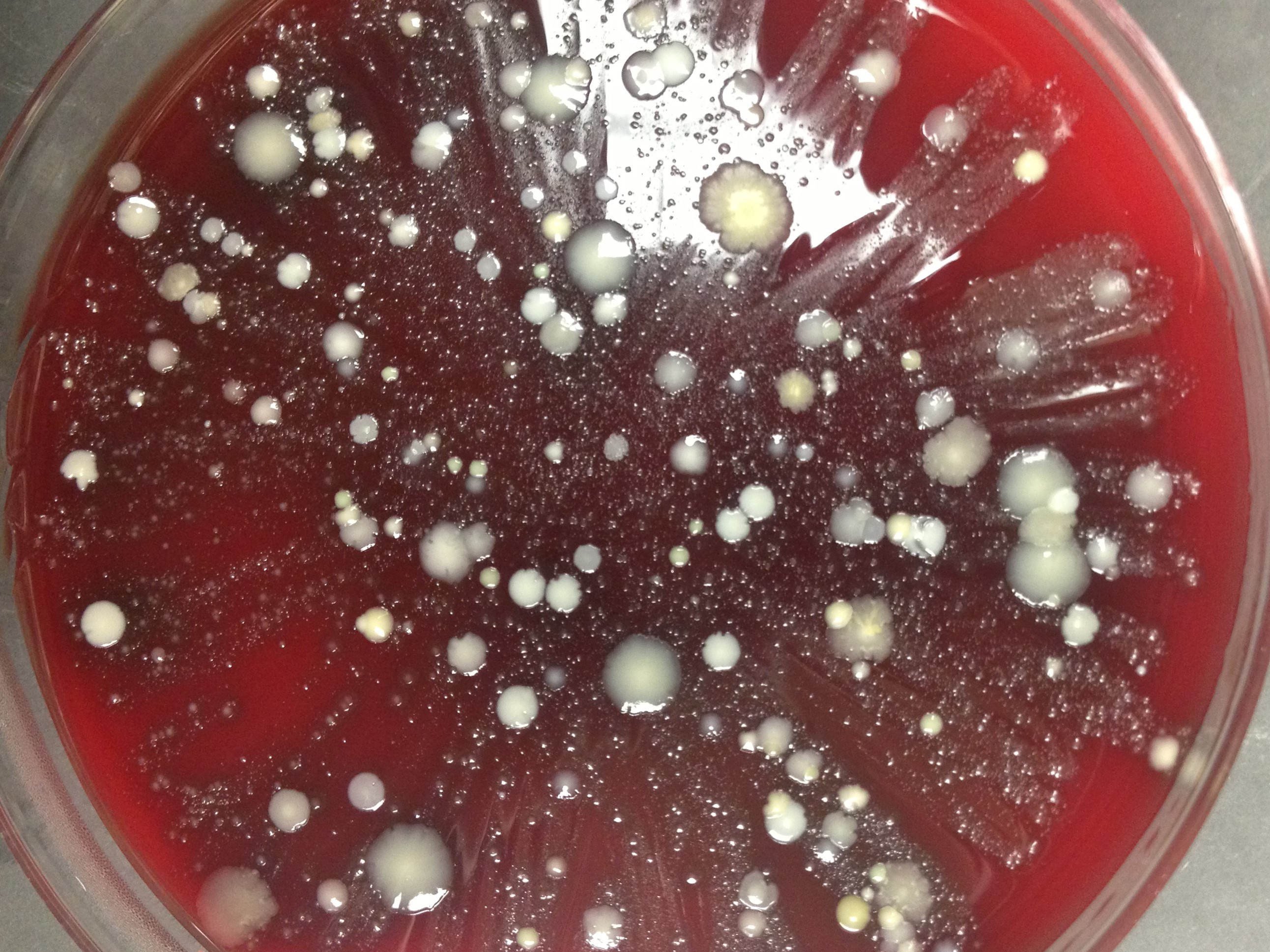 A Golden Opportunity: Eliminating Dogma about the Bladder’s Microbiome