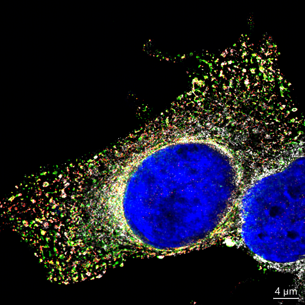How a Cellular “Gatekeeper” Helps Viruses Thrive: Exploring NUP153 in Flavivirus Infections