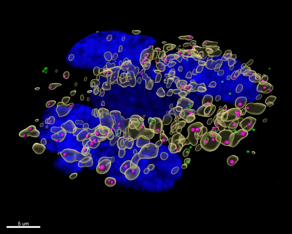 Addicted to sugar and fat - how hepatitis A virus invades cells