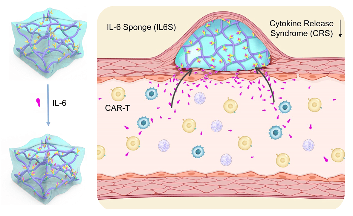 Suppression of cytokine release syndrome during CAR-T-cell therapy via an “IL-6 sponge”