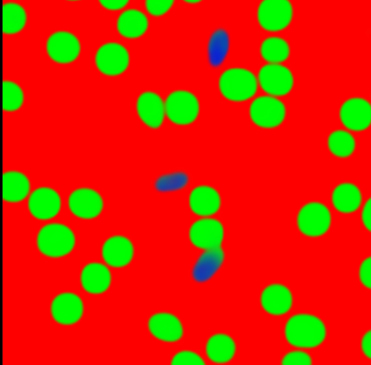 Deep learning-based screening of sickle cell disease using a mobile microscope