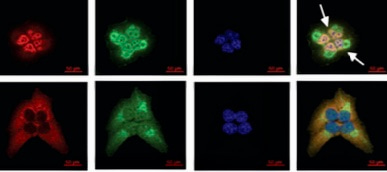 Serum deprivation initiates adaptation and survival to oxidative stress in prostate cancer cells