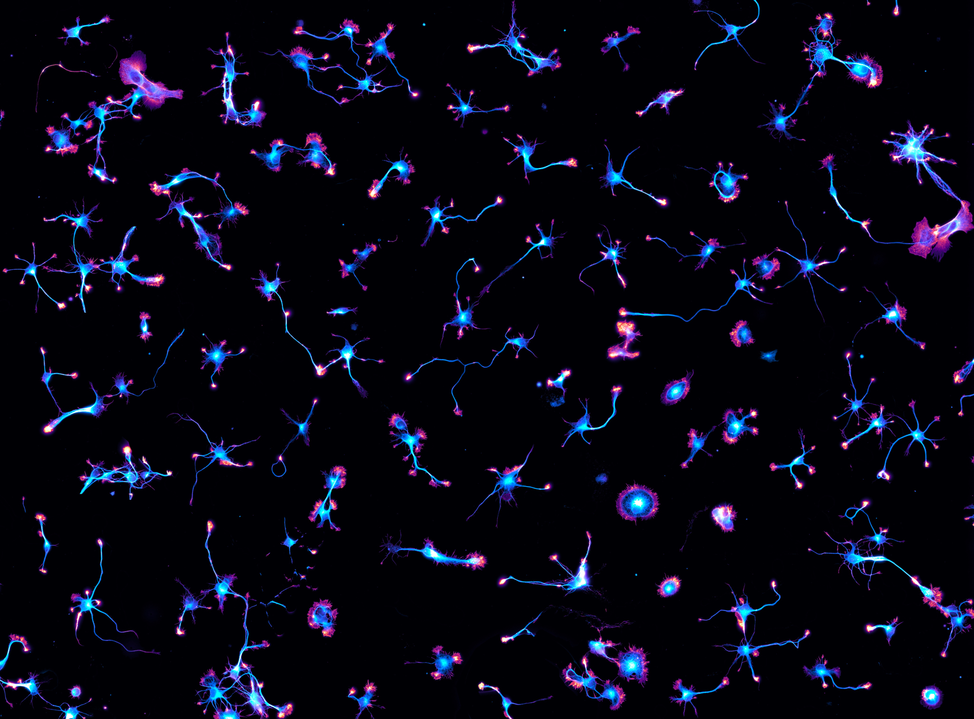 Cytoskeleton moves