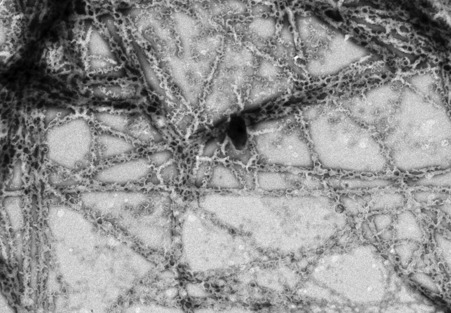 Spot the difference – cells or protocells?