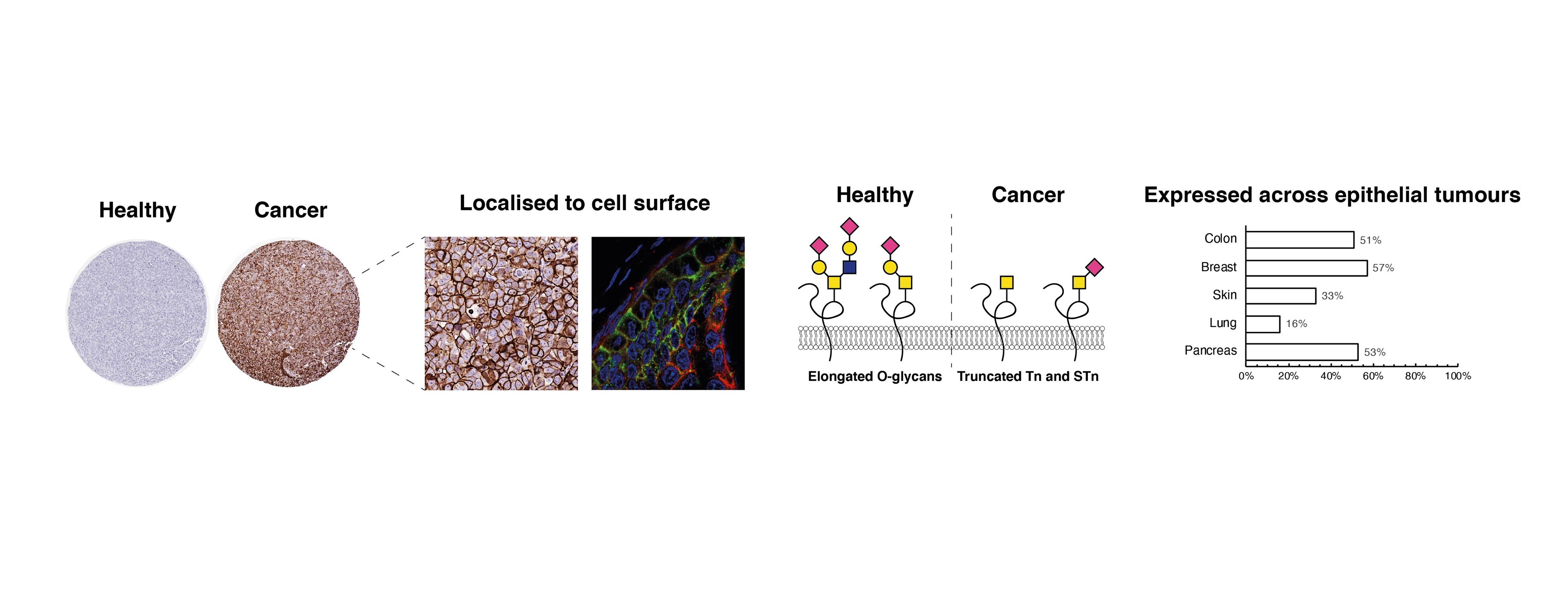 Mapping of the Sweet (and Drug-able) Secrets of Cancers