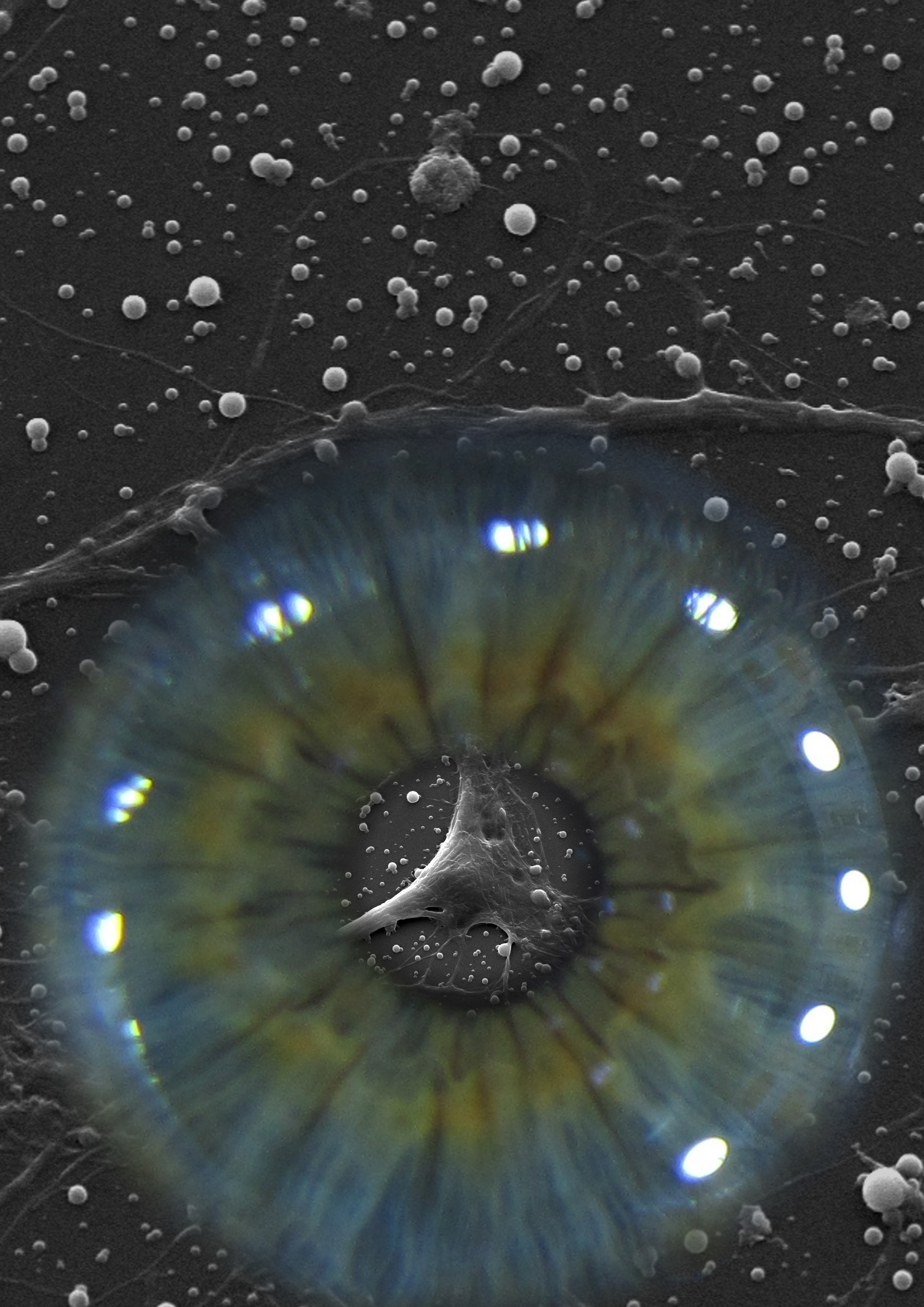 SUBRETINALLY INJECTED SEMICONDUCTING POLYMER NANOPARTICLES RESCUE VISION IN A RAT MODEL OF RETINAL DYSTROPHY