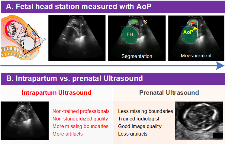 Obstetric Ultrasound Imaging and Biometry